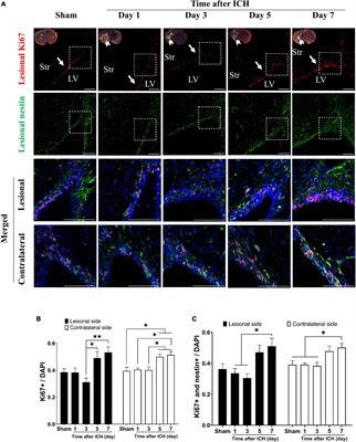 Brain-derived neurotrophic factor contributes to neurogenesis after intracerebral hemorrhage: a rodent model and human study